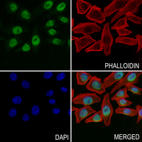 3 - Anti-Histone H3 (DiMethyl-K36) Antibody AP61428