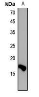 1 - Anti-Histone H3 (DiMethyl-K36) Antibody AP61428