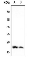 1 - Anti-Histone H3 (DiMethyl-K4) Antibody AP61430