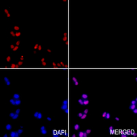 3 - Anti-Histone H3 (TriMethyl-K4) Antibody AP61431