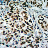 19 - Anti-Histone H3 (TriMethyl-K4) Antibody AP61431