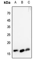 1 - Anti-Histone H3 (TriMethyl-K4) Antibody AP61431