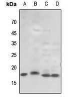 1 - Anti-Histone H3 (TriMethyl-K79) Antibody AP61432