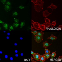 3 - Anti-Histone H3 (MonoMethyl-R8) Antibody AP61433