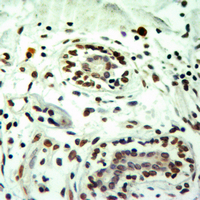 19 - Anti-Histone H3 (MonoMethyl-R8) Antibody AP61433