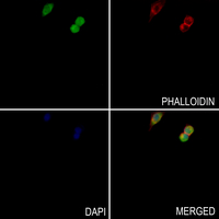 3 - Anti-Histone H3 (MonoMethyl-K18) Antibody AP61434