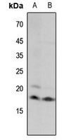 1 - Anti-Histone H3 (MonoMethyl-K18) Antibody AP61434