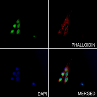 3 - Anti-Histone H4 (MonoMethyl-K5) Antibody AP61436