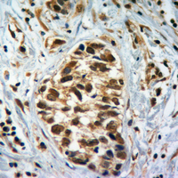 19 - Anti-Histone H4 (MonoMethyl-K5) Antibody AP61436