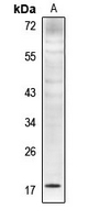 1 - Anti-Histone H4 (MonoMethyl-K5) Antibody AP61436