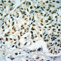 19 - Anti-Histone H4 (MonoMethyl-R19) Antibody AP61438