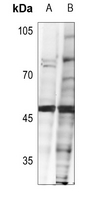 1 - Anti-FOXH1 Antibody AP61441