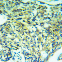 19 - Anti-USP51 Antibody AP61444