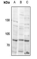 1 - Anti-USP51 Antibody AP61444