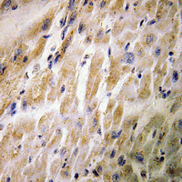 19 - Anti-MEF2C (Phospho-S387) Antibody AP61445