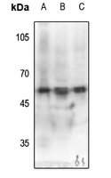 1 - Anti-MEF2C (Phospho-S387) Antibody AP61445