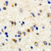 19 - Anti-Rhodopsin (Phospho-S334) Antibody AP61446