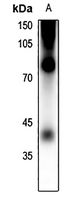 1 - Anti-Rhodopsin (Phospho-S334) Antibody AP61446