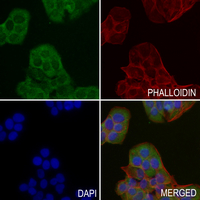 3 - Anti-Aquaporin 2 (Phospho-S256) Antibody AP61447