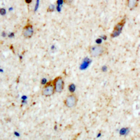 19 - Anti-Aquaporin 2 (Phospho-S256) Antibody AP61447