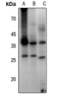 1 - Anti-Aquaporin 2 (Phospho-S256) Antibody AP61447
