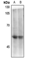 1 - Anti-CD4 (Phospho-S433) Antibody AP61448