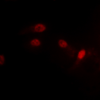 3 - Anti-MDM2 (Phospho-S186/S188) Antibody AP61449