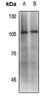 1 - Anti-MDM2 (Phospho-S186/S188) Antibody AP61449