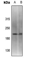 1 - Anti-Topoisomerase 2 alpha (Phospho-S1213) Antibody AP61450