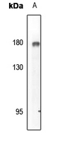 1 - Anti-EGFR (Phospho-Y869) Antibody AP61451