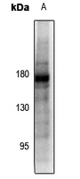 1 - Anti-PDGFR beta (Phospho-Y857) Antibody AP61452