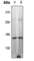 1 - Anti-DAP Kinase 1 (Phospho-S308) Antibody AP61453