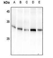 1 - Anti-14-3-3 sigma (Phospho-S186) Antibody AP61454