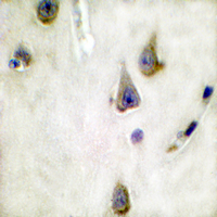 19 - Anti-DARPP32 Antibody AP61455