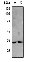 1 - Anti-DARPP32 Antibody AP61455