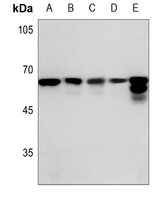 1 - Anti-FYN Antibody AP61456