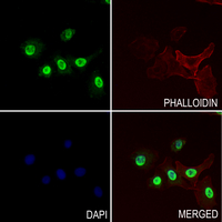 3 - Anti-p27 Kip1 Antibody [KO/KD Validated] AP61460
