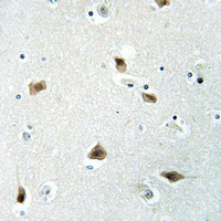 19 - Anti-p27 Kip1 Antibody [KO/KD Validated] AP61460