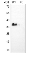 0 - Anti-p27 Kip1 Antibody [KO/KD Validated] AP61460