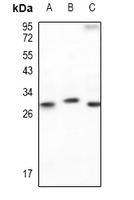 1 - Anti-p27 Kip1 Antibody [KO/KD Validated] AP61460