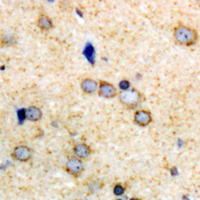 19 - Anti-Kv2.1 Antibody AP61462