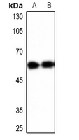 1 - Anti-YBX1 Antibody AP61463