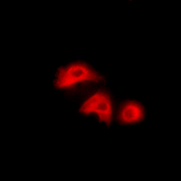 3 - Anti-Adenylate Kinase 1 Antibody AP61464
