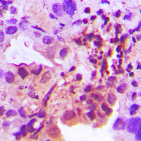 19 - Anti-Adenylate Kinase 1 Antibody AP61464