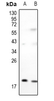 1 - Anti-Adenylate Kinase 1 Antibody AP61464
