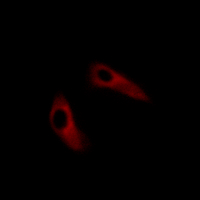 3 - Anti-KCHIP1 Antibody AP61465