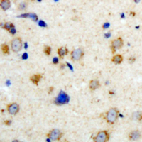19 - Anti-KCHIP1 Antibody AP61465
