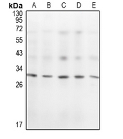 1 - Anti-KCHIP1 Antibody AP61465