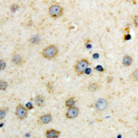 19 - Anti-Adenylate Cyclase 7 Antibody AP61466
