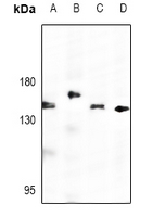 1 - Anti-Adenylate Cyclase 7 Antibody AP61466